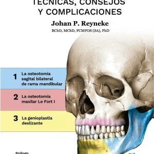 CIRUGÍA ORTOGNÁTICA. TÉCNICAS, CONSEJOS Y COMPLICACIONES