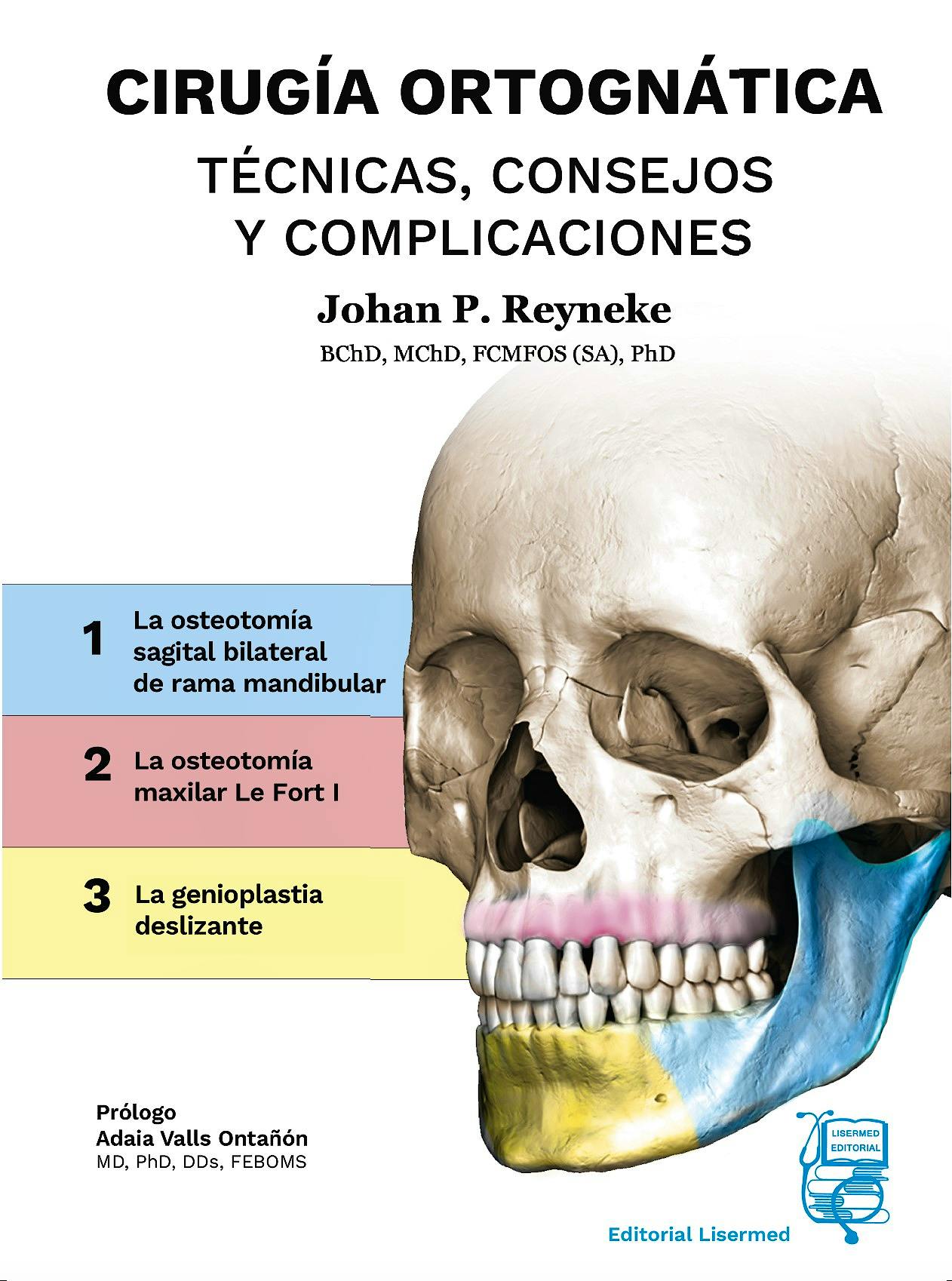 CIRUGÍA ORTOGNÁTICA. TÉCNICAS, CONSEJOS Y COMPLICACIONES